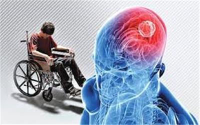افزایش 25 درصدی بیماری ام اس در منطقه تربت حیدریه