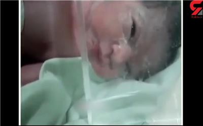 عجیب ترین حاملگی یک زن ایرانی / شوک هنگام زایمان در بیمارستان
